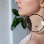 Значення родимок на тілі – пояснення