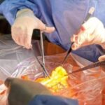 Життя, яке народилося зі смерті: в Одесі здійснили неперевершену пересадку органів.