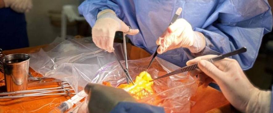 Життя, яке народилося зі смерті: в Одесі здійснили неперевершену пересадку органів.