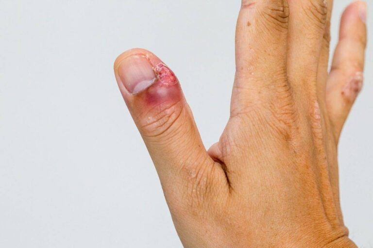 Проверенные препараты для ускорения заживления