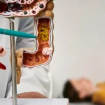 Як ендоскопія допомагає виявити рак тонкого кишечника