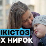 Життя хлопчика з пересадженою ниркою: його шлях навчання та зростання в Одесі