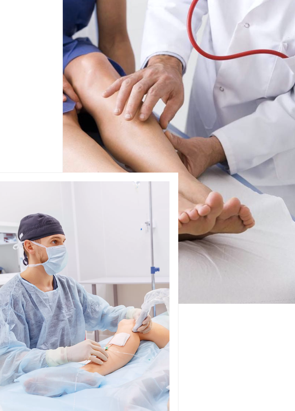Эстетическая флебология: как вернуть красоту ног без шрамов и длительной реабилитации