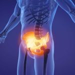 Хронічний тазовий біль у чоловіків: чому важливо об’єднати зусилля уролога та проктолога