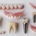 Уход за зубными протезами: как продлить их срок службы