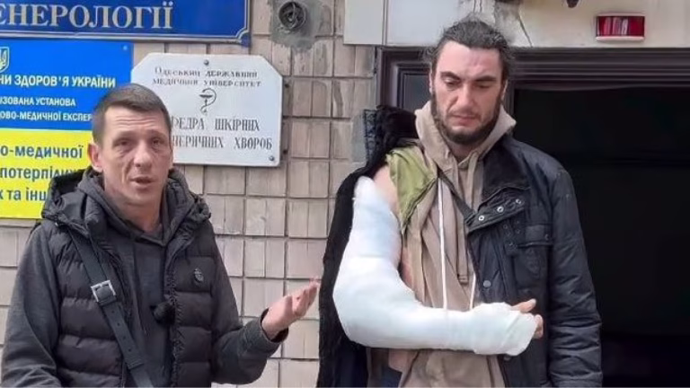 В Одесі розслідують інцидент: ветерану з інвалідністю зламали руку