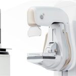 З’ясовано причину відсутності мамографів у двох лікарнях Болградського району