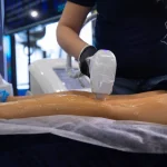 Діодний лазер для епіляції і апарат лазерної епіляції: як оцінити можливості обладнання перед покупкою