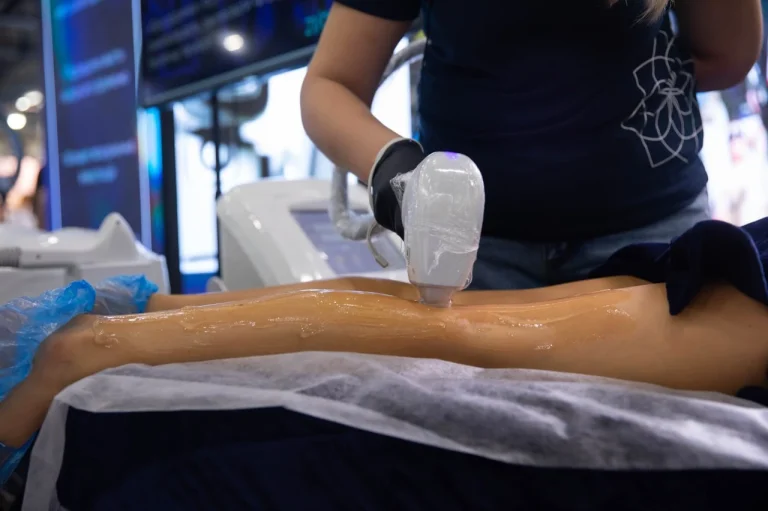 Діодний лазер для епіляції і апарат лазерної епіляції: як оцінити можливості обладнання перед покупкою