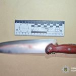 Під час застілля на Одещині чоловік зняв скальп із знайомого — ФОТО