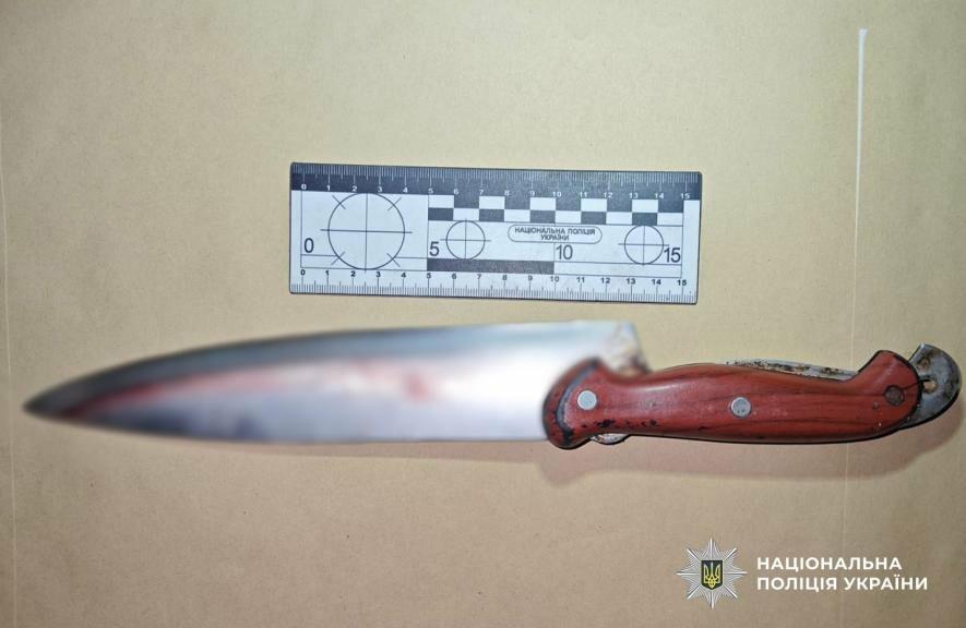 Під час застілля на Одещині чоловік зняв скальп із знайомого — ФОТО