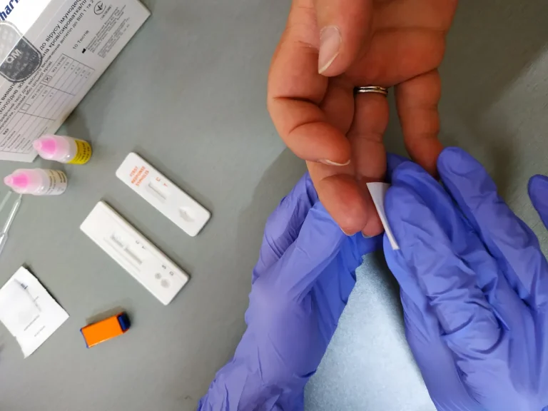 Безкоштовно та конфіденційно: тестування на ВІЛ і гепатити в Одесі та області