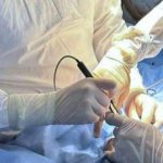 В Одесі медики успішно врятували немовля з рідкісною аномалією кишечника