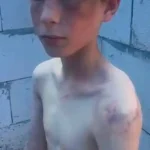 На Одещині затримали прийомну матір, підозрювану в катуванні дитини