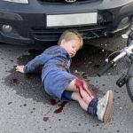 Поблизу Одеси автомобіль збив дитину на велосипеді