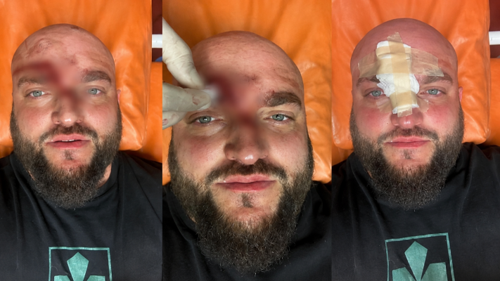 На Одещині після відпочинку невідомі жорстоко побили військовослужбовця