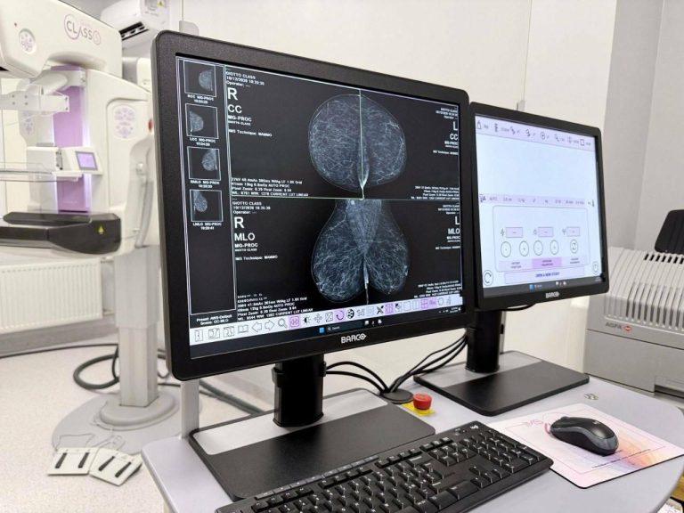 В Одесі розпочав роботу сучасний тривимірний апарат для мамографії — куди звертатися для безоплатного обстеження молочних залоз